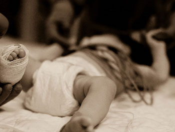 Infant in foot bandage